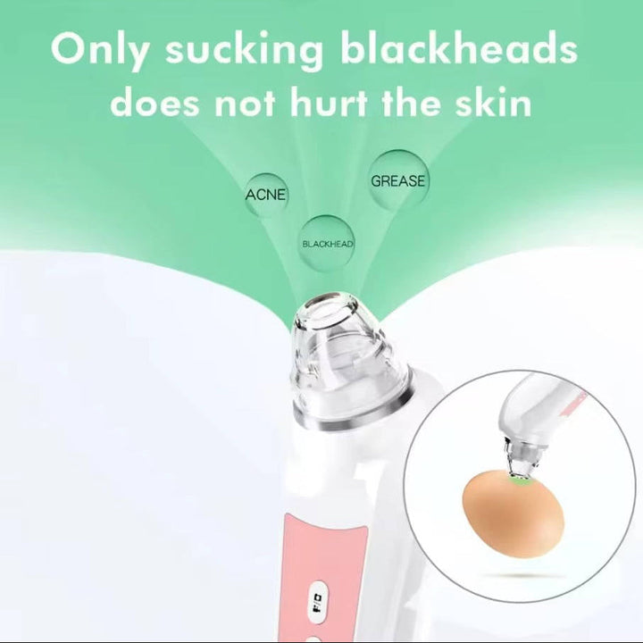 Blackhead Remover Vacuum with Camera, USB Interface Type Pore Vacuum, Black Head Extractions Tool