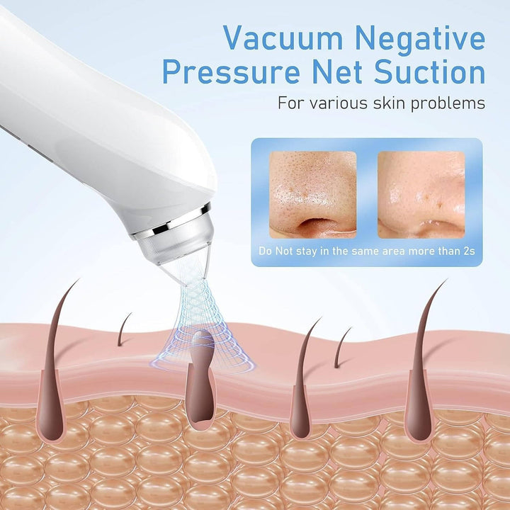 Blackhead Remover Vacuum with Camera, USB Interface Type Pore Vacuum, Black Head Extractions Tool